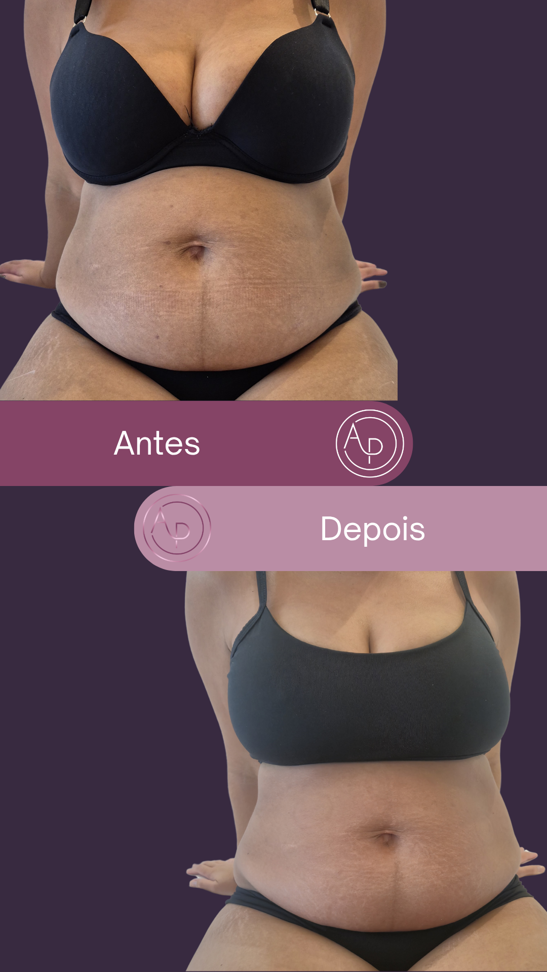 Resultado 2
