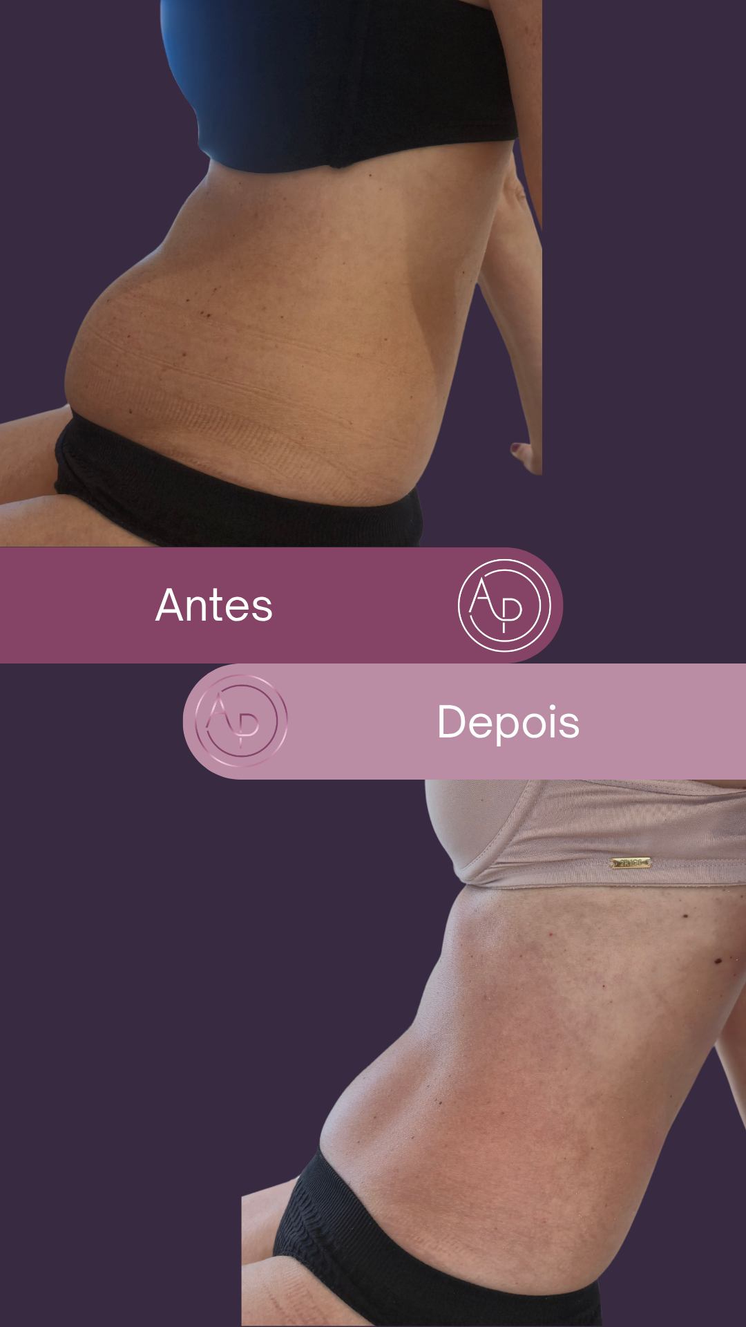 Resultado 3