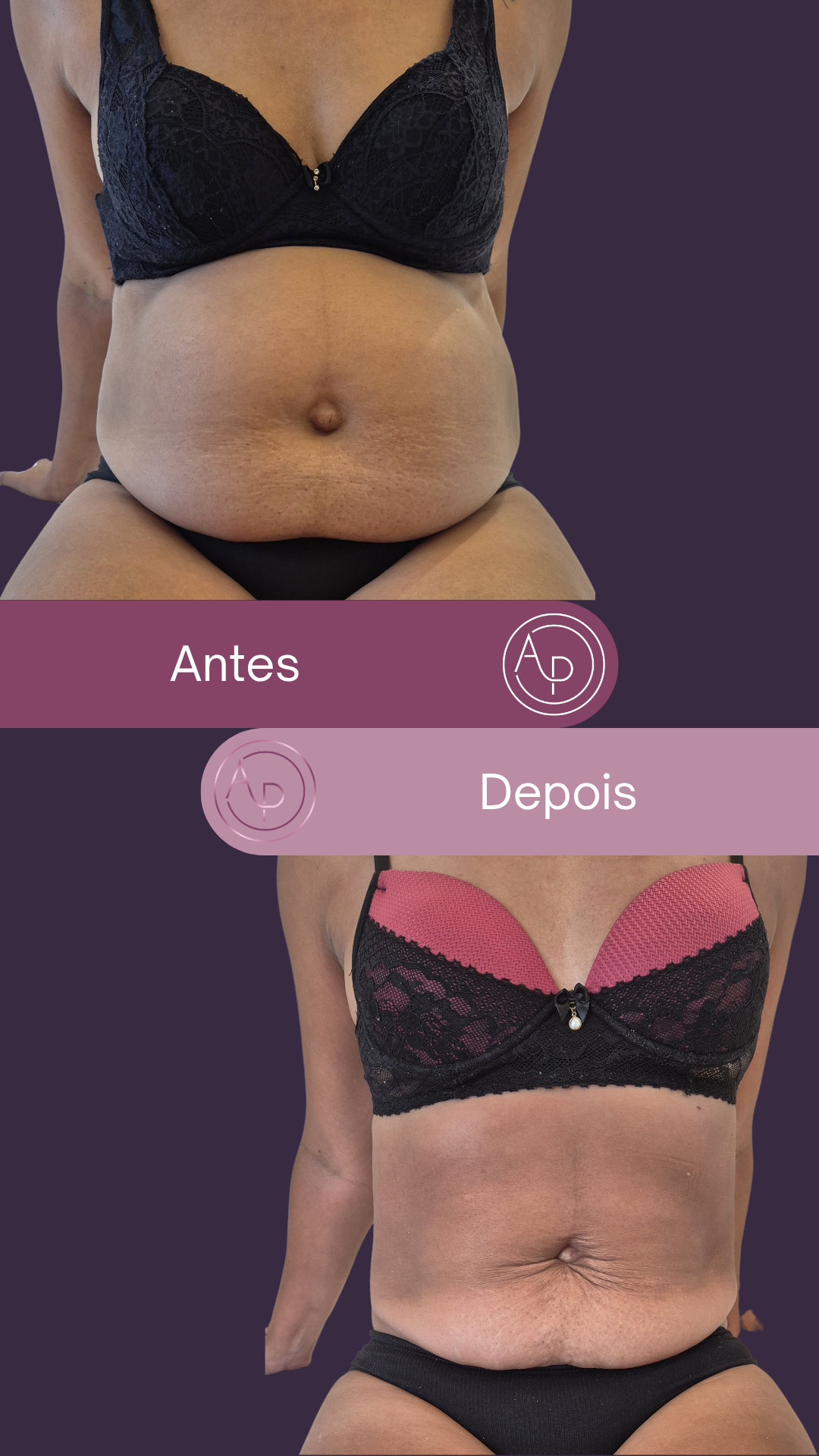 Resultado 8