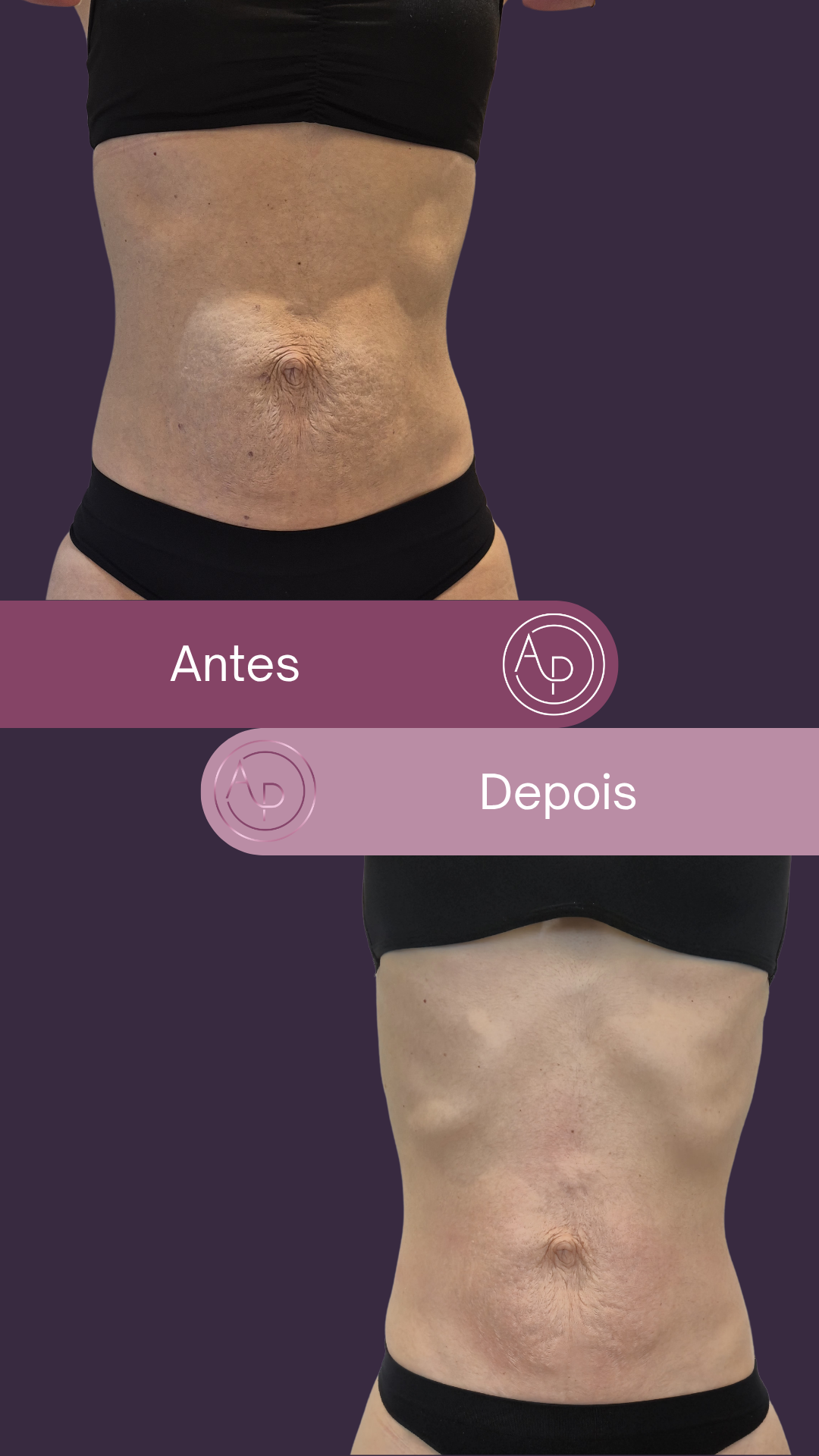 Resultado 9