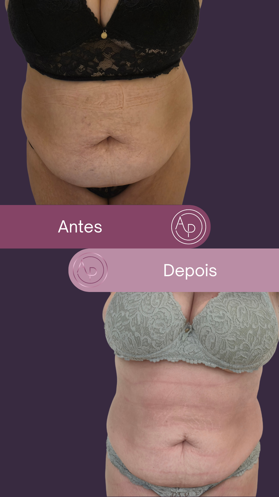 Resultado 10