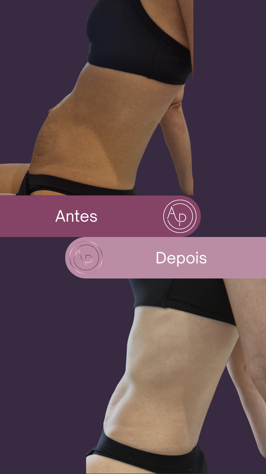 Resultado 12