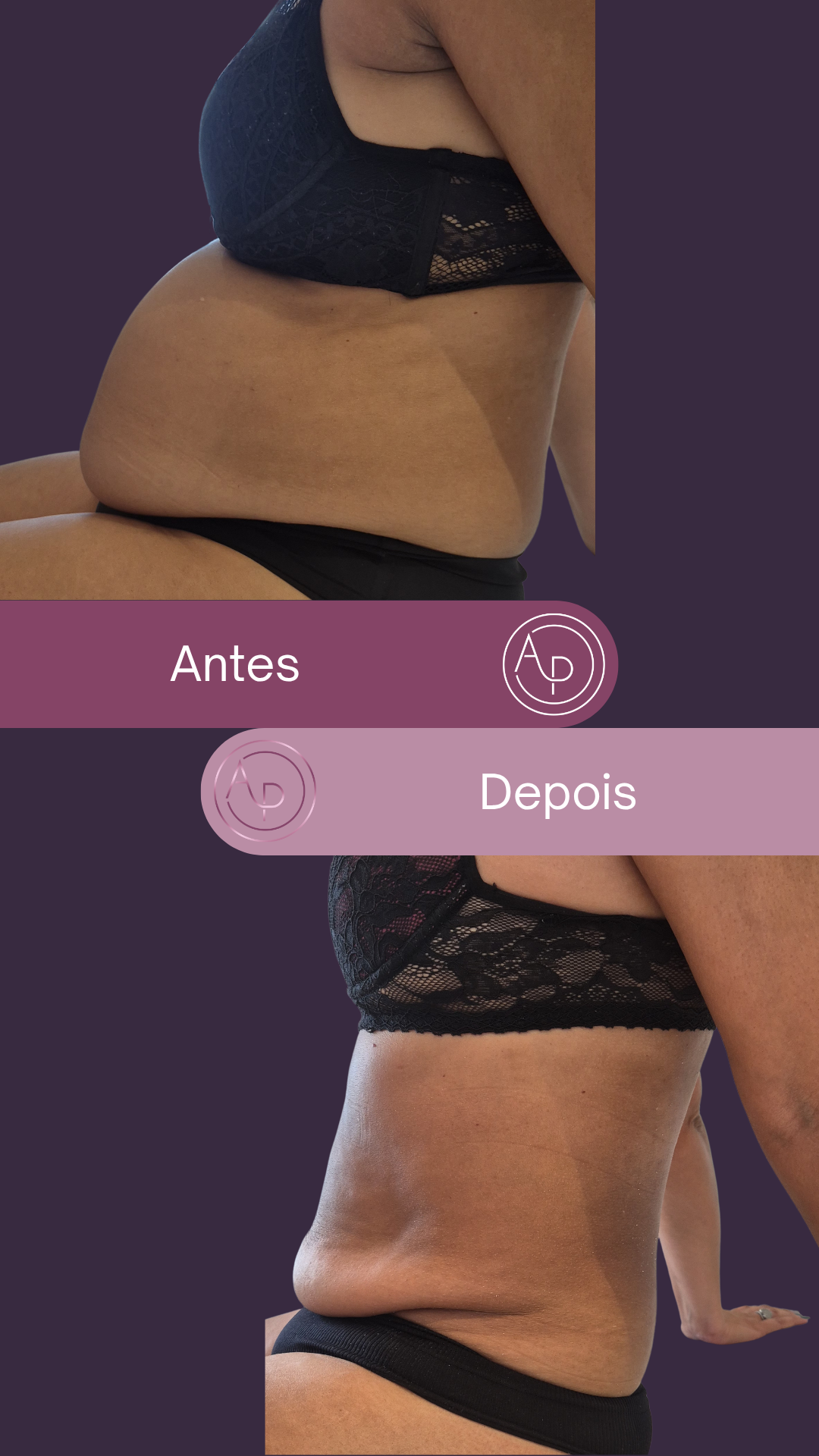 Resultado 13