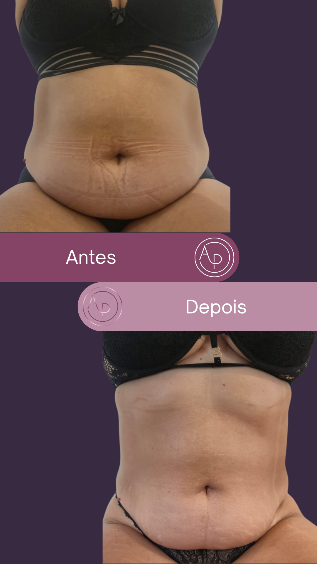 Resultado 15
