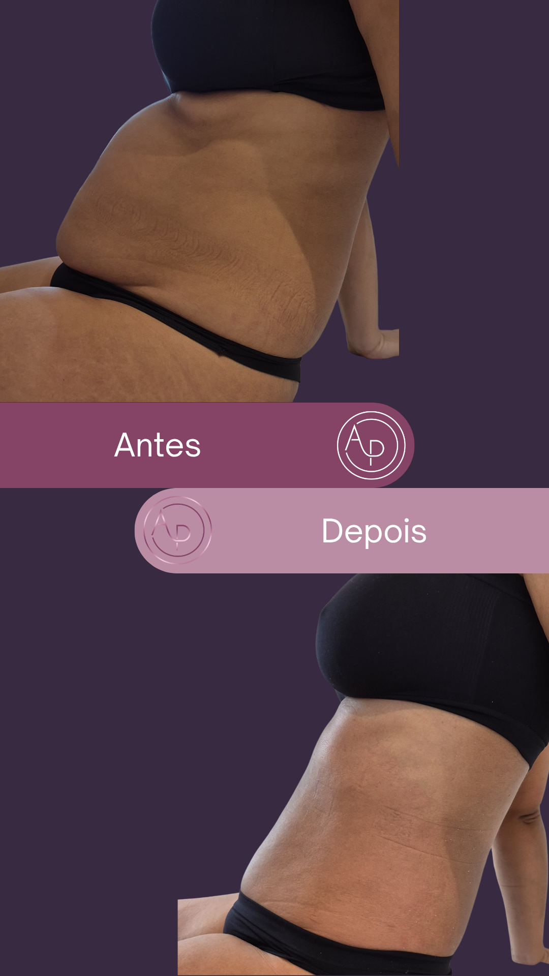 Resultado 18